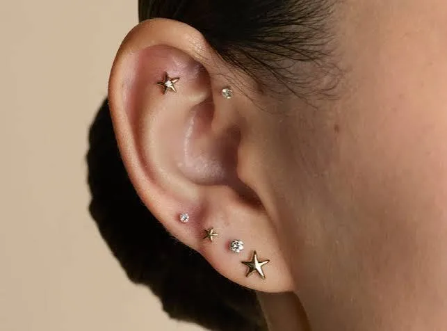 Can Earlobe Repair Restore a More Natural Earring Position? - image 1