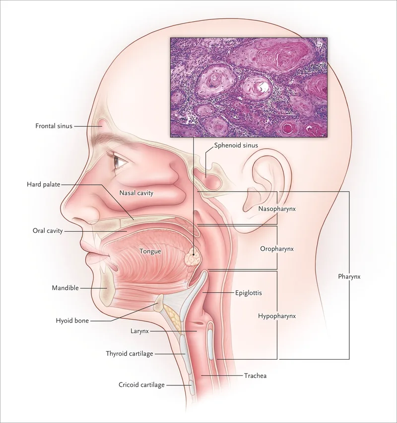 Best Head and Neck Cancer Treatment Expert in Noida | Cancer Consult - image 1