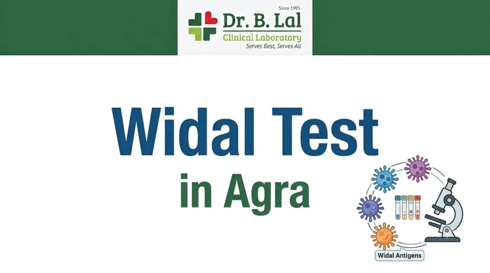 Widal Test for Children & Adults in Agra | Dr. B. Lal Lab - image 1