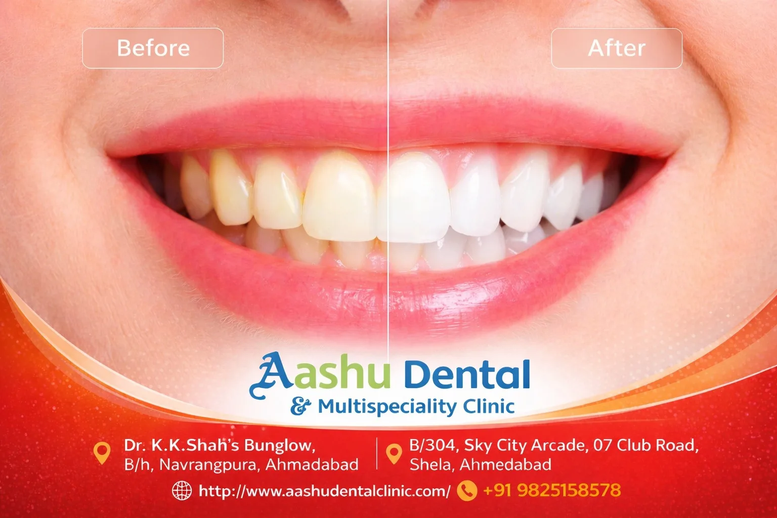 Restore Your Smile with Full Mouth Rehabilitation Treatment - image 1