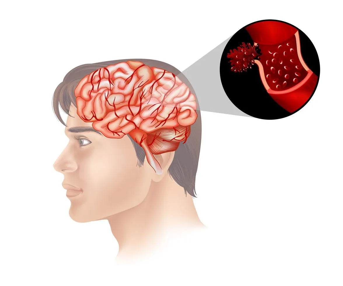 Brain Cancer Diagnosis and Care in Noida | Dr. Manish Singhal - image 1
