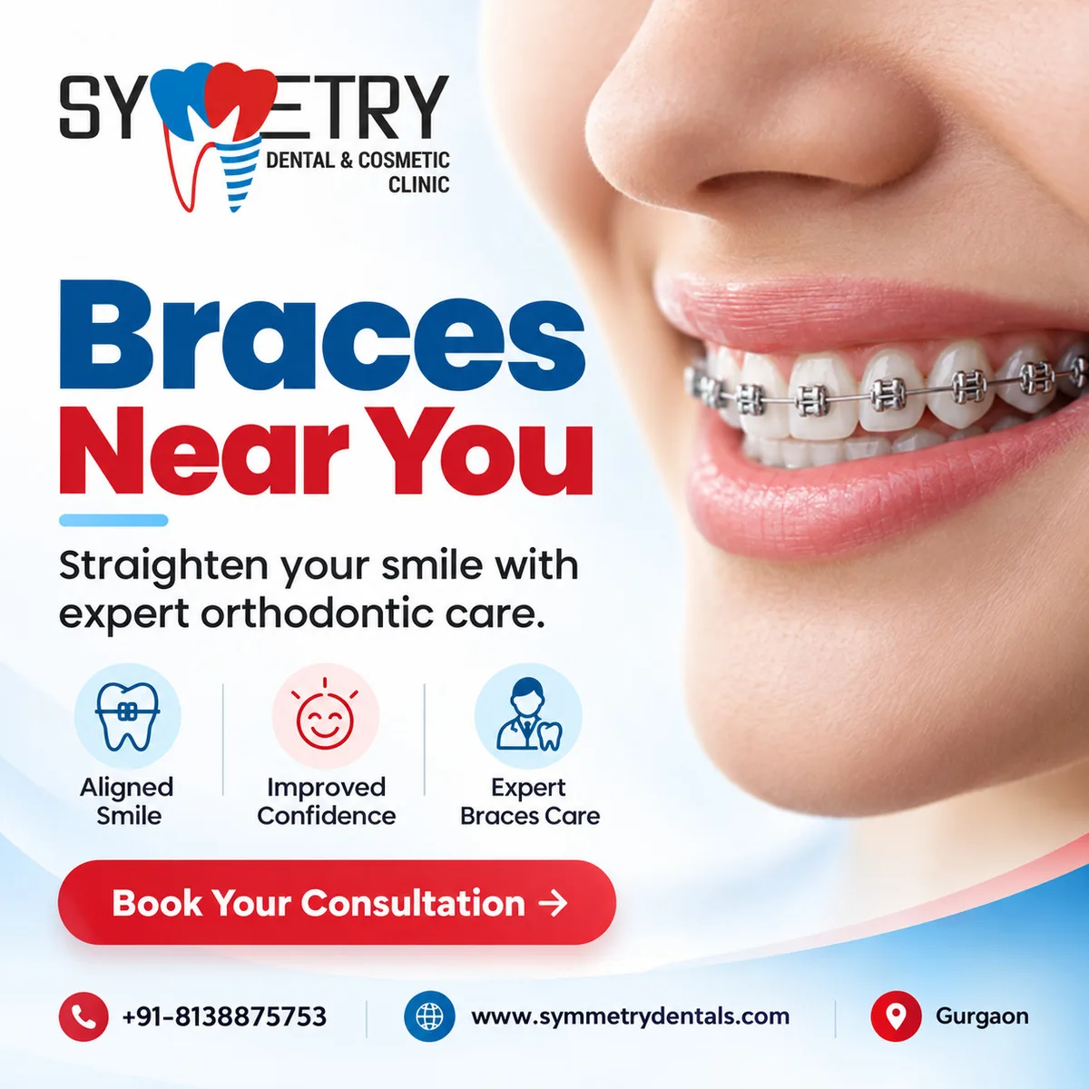 Braces near you for Straighter Teeth and Better Alignment - image 1