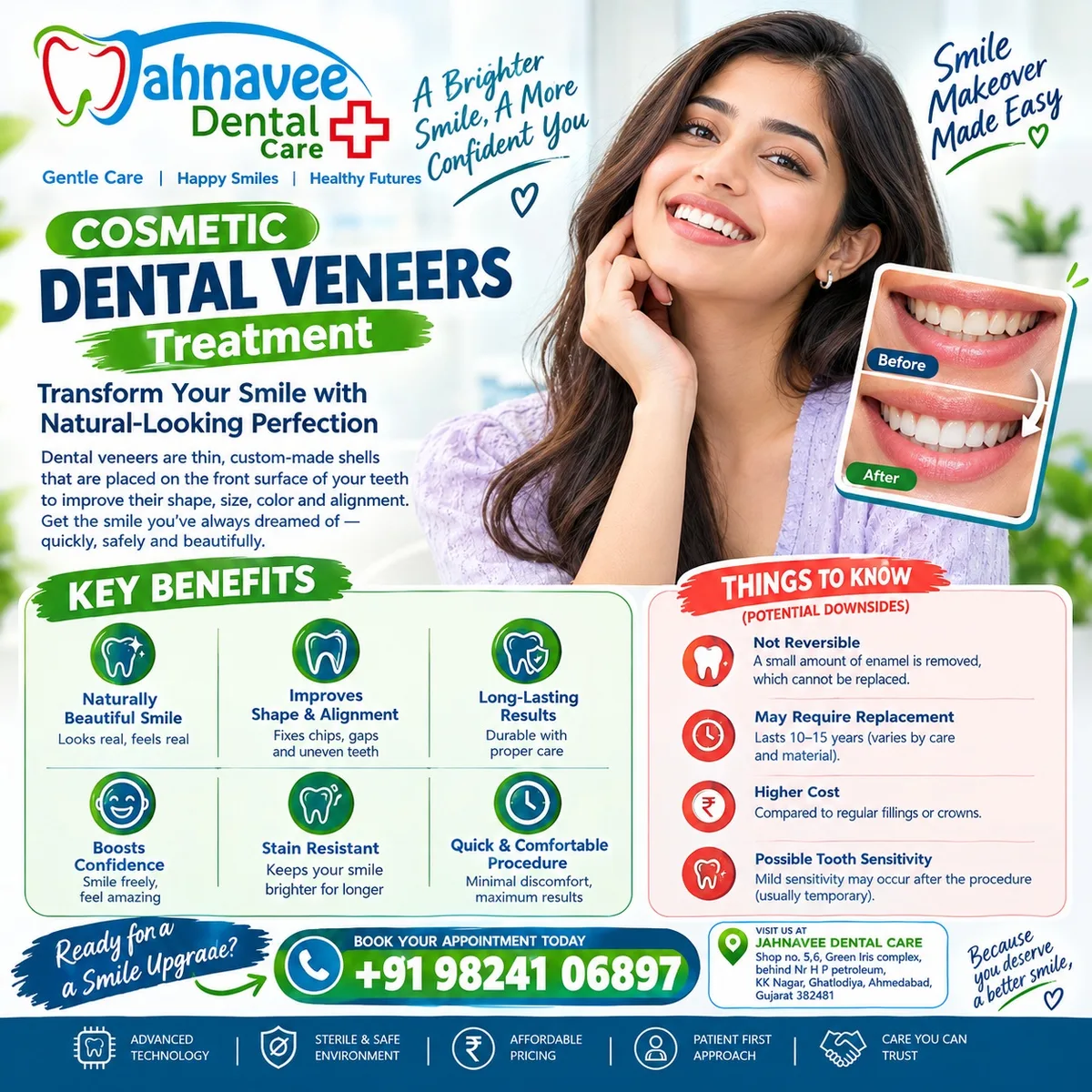 Cosmetic Dental Veneers Treatment in Ahmadabad | Dental Care - image 1