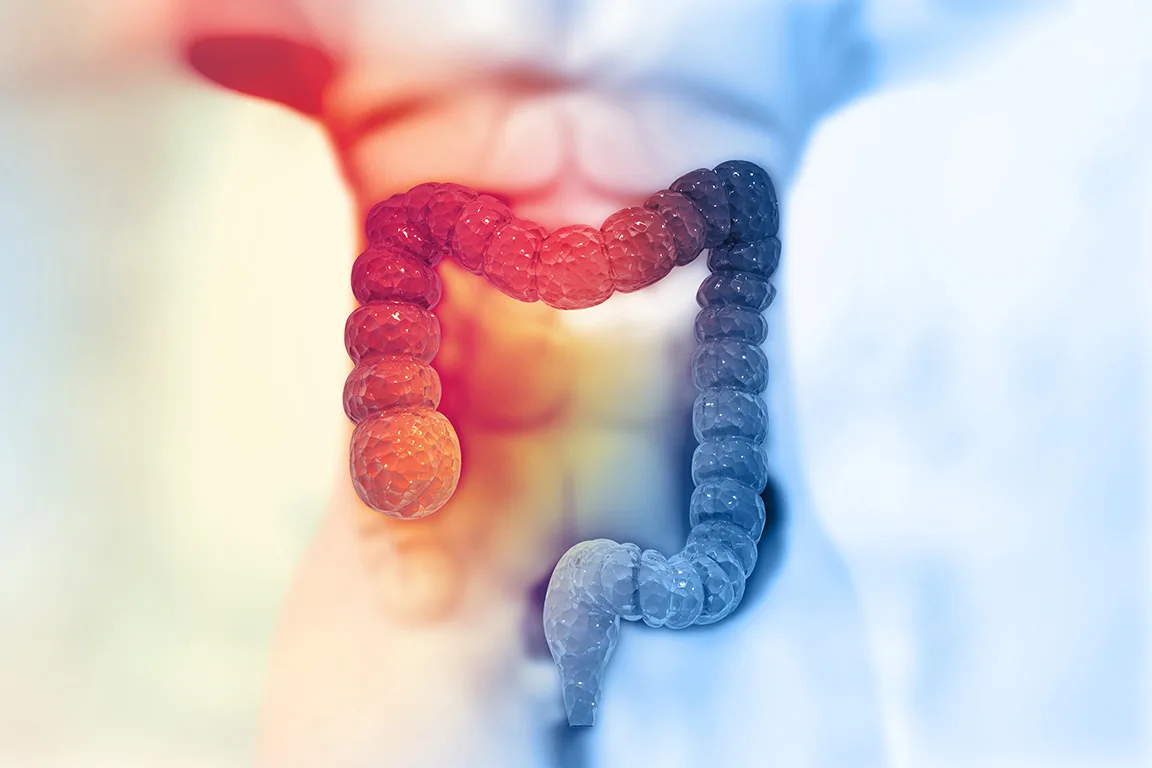 Colon Cancer Care & Treatment in Noida | Dr. Manish Singhal - image 1