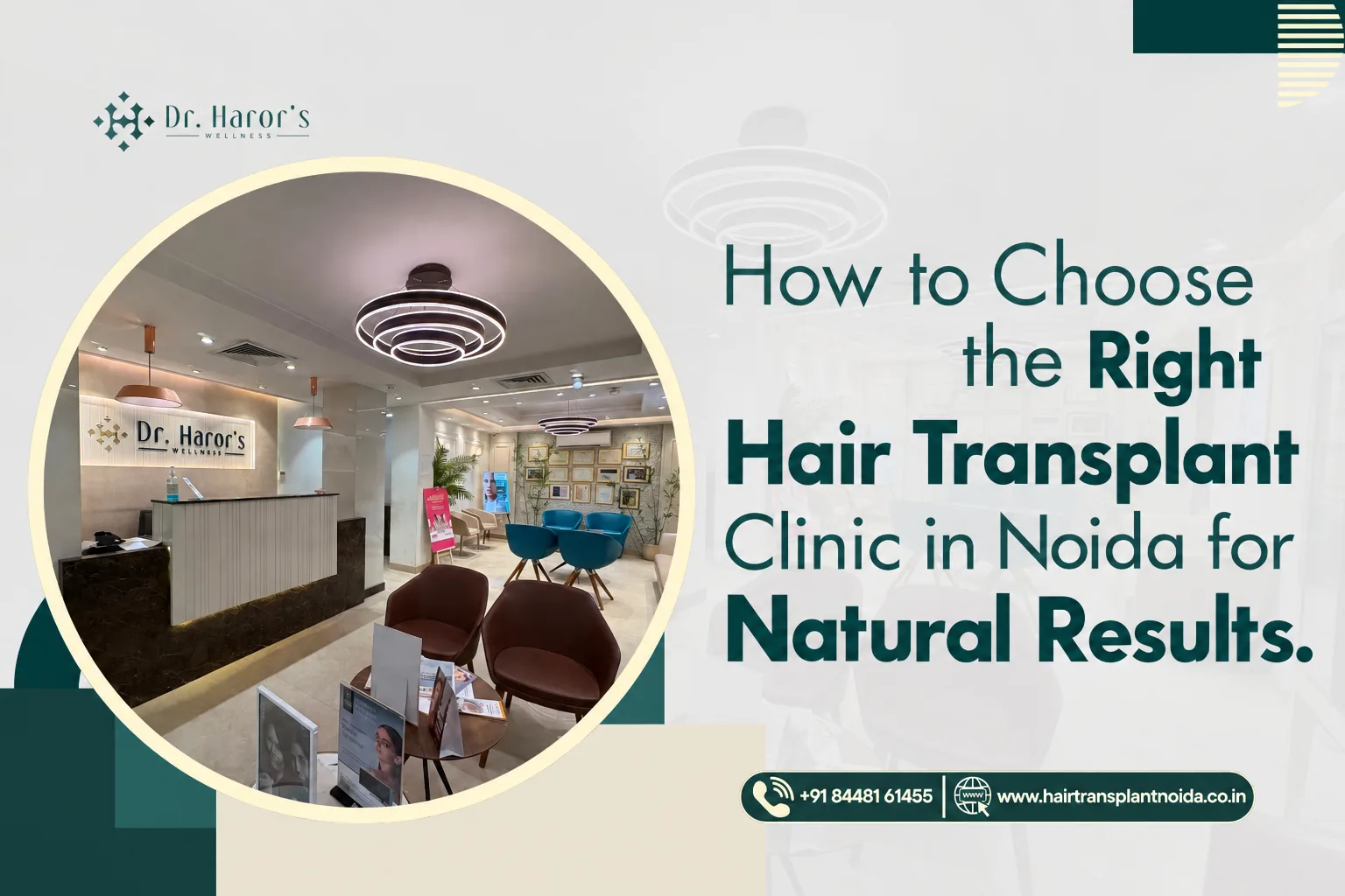 How to Choose the Right Hair Transplant Clinic in Noida for Natural Results - image 1