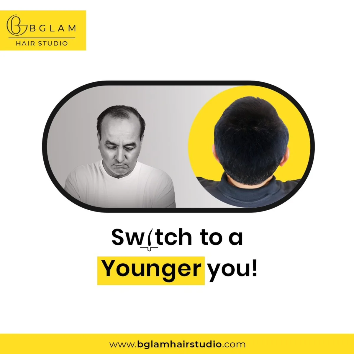 Hair Patch Services in Banashankari, Bangalore | Bglam Hair Studio - image 1