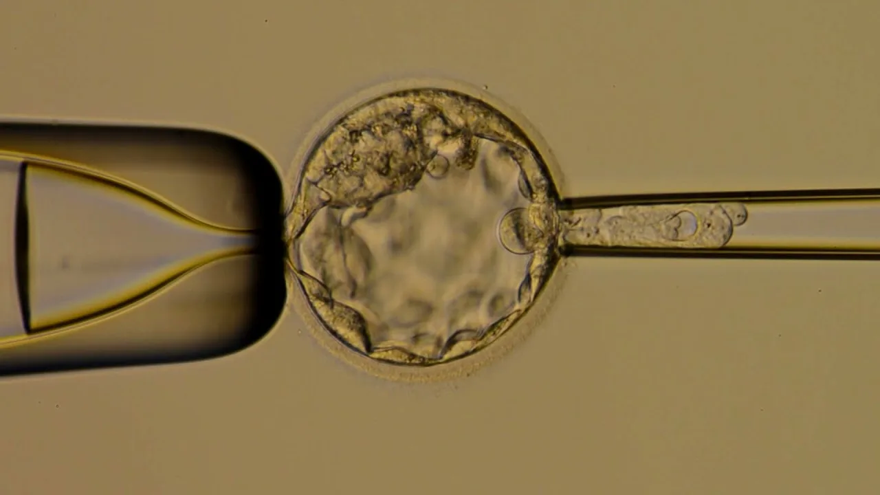 Blastocyst Transfer in Delhi with Personalized IVF Care | Fertylity IVF - image 1